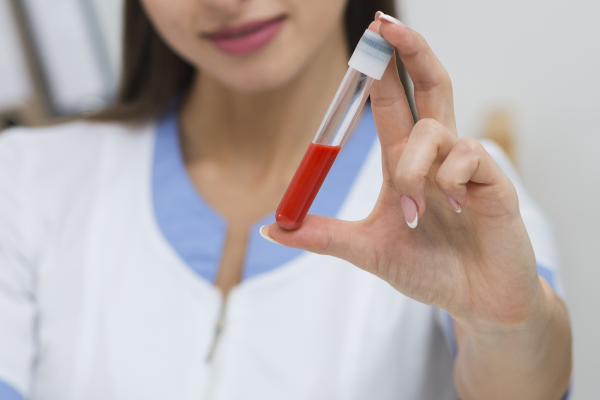 A person holding a test tube with a sample of blood for a magnesium test